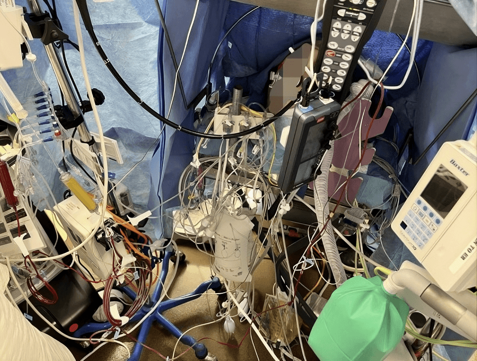 Spaghetti Syndrome: Lines, Tubes & Cables