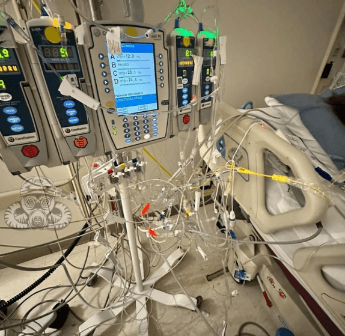 ICU Cable & Line Accumulation
