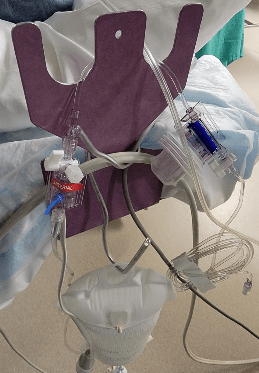 Transducer Positioning & Stability — field photo 3