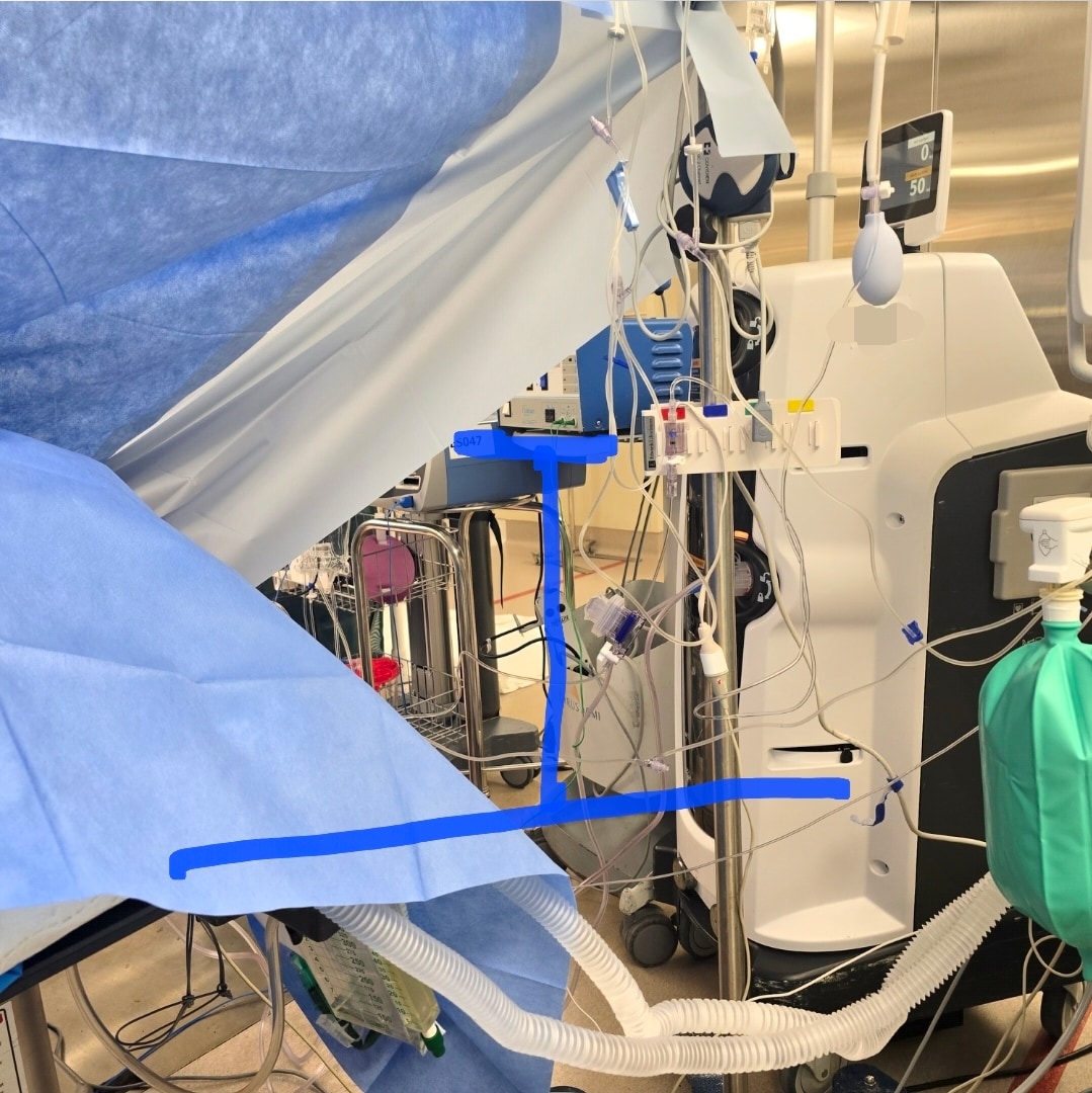 Transducer Positioning & Stability — field photo 6