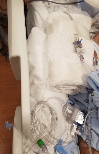 Improvised Positioning Workarounds — field photo 2