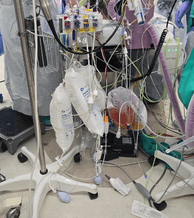 Line-Pressure Bags & Foley Bag Placement