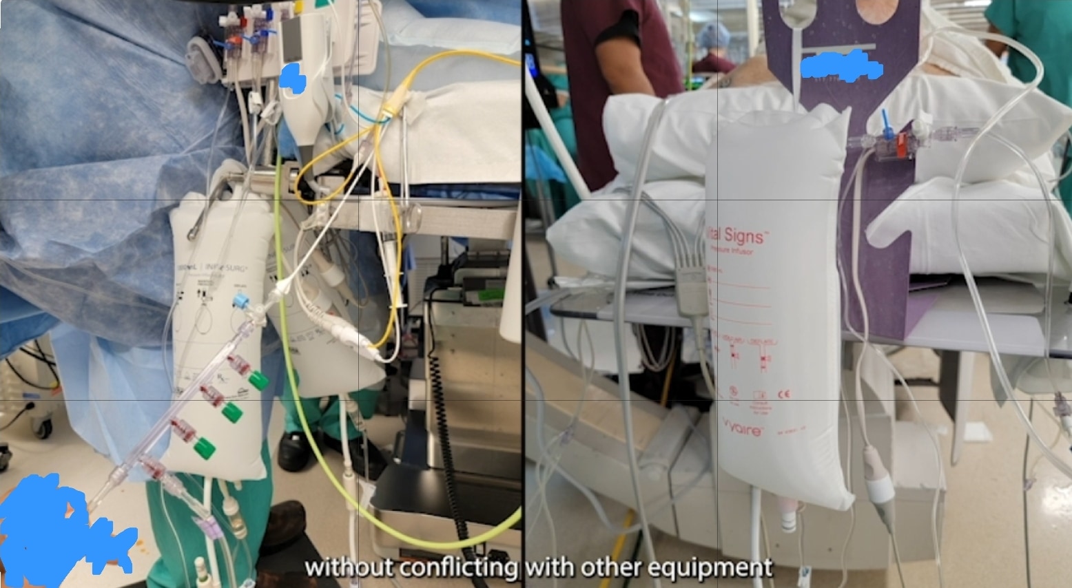 Line-Pressure Bags & Foley Bag Placement — field photo 3